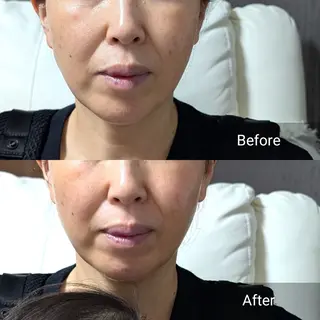 nail RiRi アトレナチュラのエステ・リラクイメージ