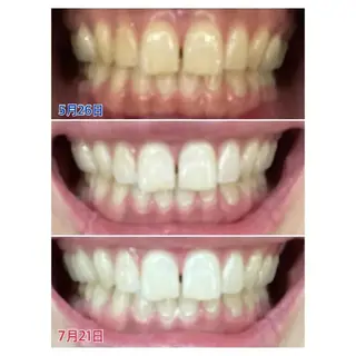 Ｍ渋谷 ホワイトニングのエステ・リラクイメージ