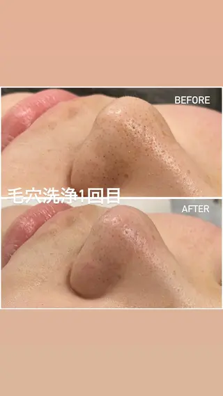 毛穴洗浄・痩身・脱毛 /アルカンジュのエステ・リラクイメージ