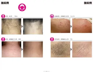 眠りの森/脱毛眉毛/ マッサージ/RINAのエステ・リラクイメージ