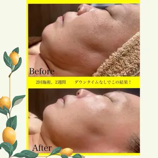 バスト美肌小顔専門 Mimpi【ミンピ】のエステ・リラクイメージ