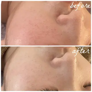 メンズ メナード岐阜市茜部 杉浦のエステ・リラクイメージ