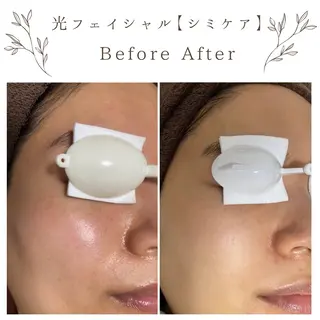 な ぎのエステ・リラクイメージ