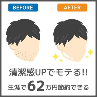 メンズ 有人型セルフサロン 脱毛/痩身/美顔のエステ・リラクイメージ