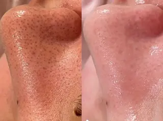 メンズ beauty salonnのエステ・リラクイメージ