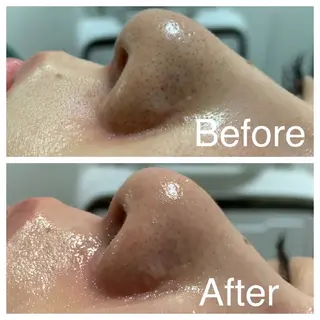 医療提携サロン新宿 La Lunaのエステ・リラクイメージ