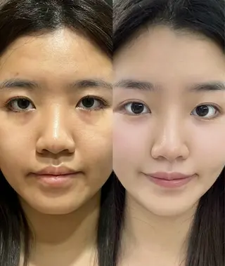 マツエク・マツパ aliaハーブ水光店 エステティシャン募集のエステ・リラクイメージ