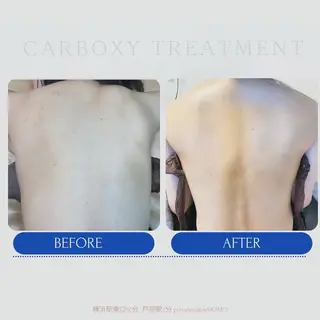 代表 MOMOのエステ・リラクイメージ