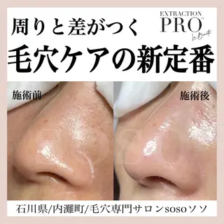 salon soso(ソソ)のエステ・リラクイメージ