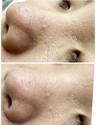 ハーブピーリングMB eautySalonのエステ・リラクイメージ