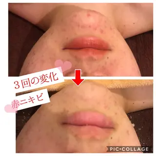 セミロング カラー パーマ ヘアアレンジ メンズ キッズ ネイル マツエク・マツパ 金の糸脱毛 産毛ケア専門のエステ・リラクイメージ