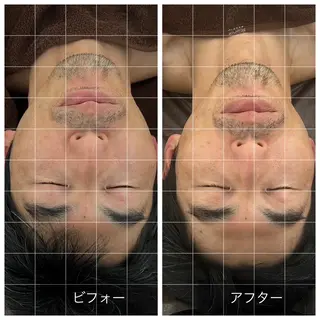 Relaxsalon undo所属・Relaxsalon undoのエステ・リラクイメージ