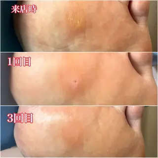 巻き爪補正店　柏店所属・巻き爪補正店 柏店のその他イメージ