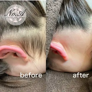 ブラジリアンワックス No.A【新宿】のエステ・リラクイメージ