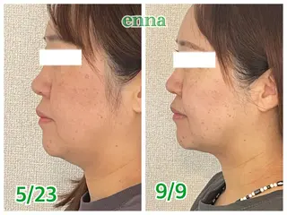 三上 笑里奈のエステ・リラクイメージ