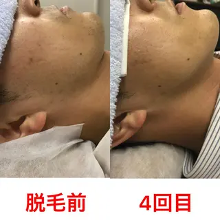 メンズ メンズ脱毛サロン ／金山昌弘のエステ・リラクイメージ