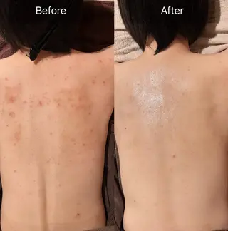 for woman所属・森 美優のエステ・リラクイメージ