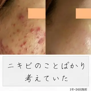 ニキビ経験者が施術 する専門サロン🌻のエステ・リラクイメージ