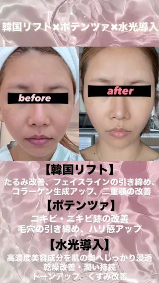 マツエク・マツパ 愛維美水光美肌専門店 メンズレディースokのエステ・リラクイメージ