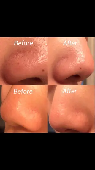 ナリス ビューティスタジオ De I'm所属・新田 彩乃のエステ・リラクイメージ