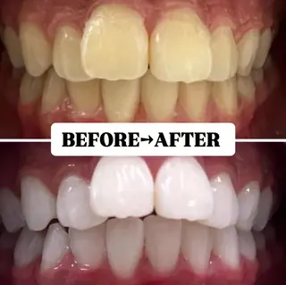 メンズ キッズ 歯科提携サロン ホワイトニング豊中のその他イメージ