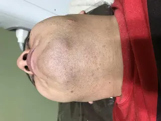 メンズ マンモス脱毛 札幌白石店のその他イメージ