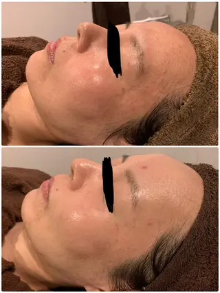 本気の肌質改善スキン デトックス🌿のエステ・リラクイメージ