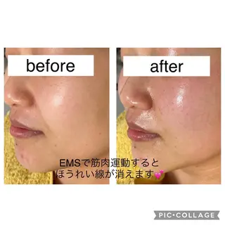 毛穴ケア・肌質改善 徳川のエステ・リラクイメージ