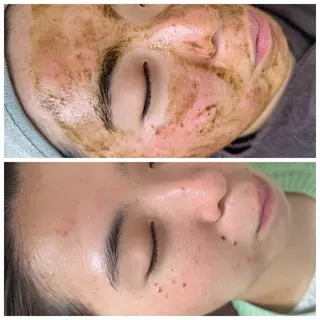 トータルしみケア専門 NICA(ニカ)の眉毛・アイブロウイメージ