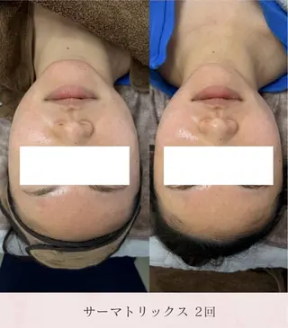 看護師が施術する美容 ナスサロshokoのエステ・リラクイメージ