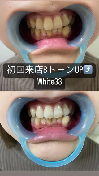 メンズ セルフホワイトニング White33大名のその他イメージ