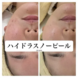 肌質管理専門店 Lé pia　AMIのエステ・リラクイメージ