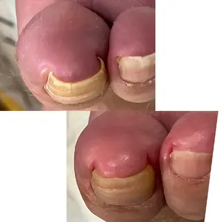 carenail　 tsugumiのその他イメージ