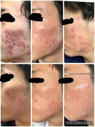 メンズ 朝重い人専用 肩甲骨調整のエステ・リラクイメージ