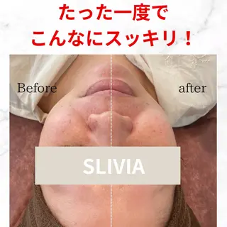 SLIVIA所属・SLIVIA 毛穴洗浄&ヘッドスパのエステ・リラクイメージ
