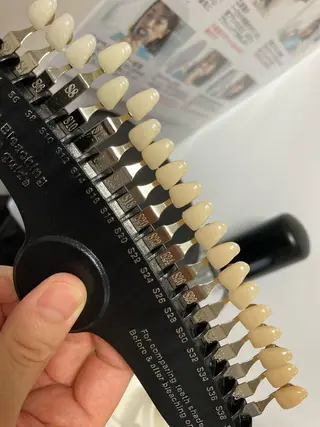 ホワイトニング シャトンのその他イメージ