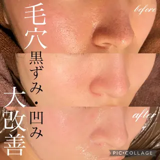 Ensor Clair所属・EnsorClair 代表　野口真央のエステ・リラクイメージ