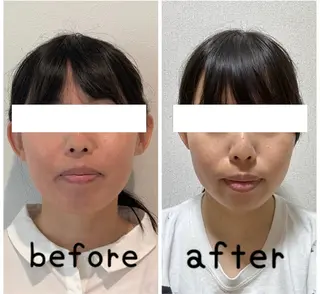 小顔と ヘッドスパのお店のエステ・リラクイメージ