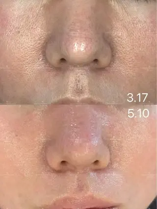 ネイル aliaハーブ水光店 エステティシャン募集のエステ・リラクイメージ