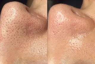 LUMINA ESTHのエステ・リラクイメージ