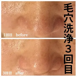 フェイシャル専門サロ ン　ERINのエステ・リラクイメージ