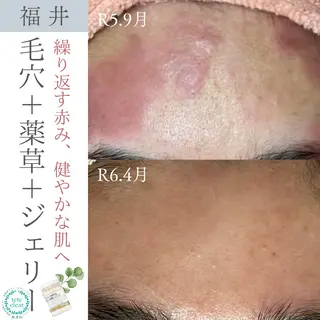 毛穴肌質ケアサロン Yourmeユアミーのエステ・リラクイメージ