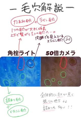 【稲毛】毛穴改善専門 Stellaのその他イメージ