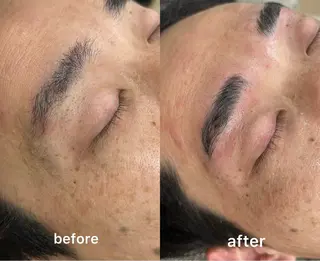 アイブロウ Akala miのエステ・リラクイメージ