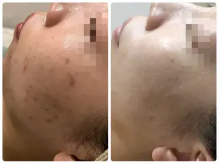 脱毛&フェイシャル 専門店muro.のエステ・リラクイメージ