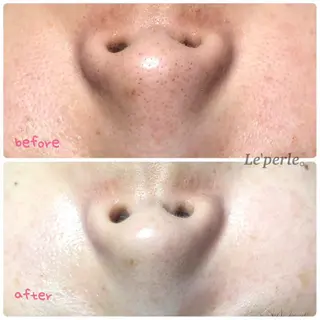 Le'perle｡所属・Le'perle｡ Kyokaのエステ・リラクイメージ