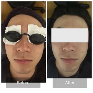 メンズ エマニエル USAのエステ・リラクイメージ