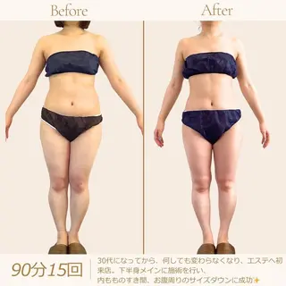 むくみ専門痩身 マクイエステティックのエステ・リラクイメージ