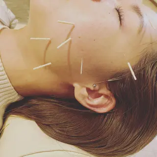 むくみたるみ専門☆ 美容鍼・小顔矯正のエステ・リラクイメージ