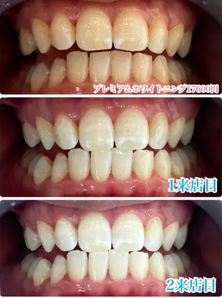 【歯科提携】柏ホワイ トニングスタイルのその他イメージ